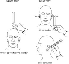 scratch test ear|The use of the weber tuning fork test and 'scratch test' in .